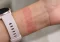 Alerginis kontaktinis dermatitas atsiranda kontakto su alergenu vietoje