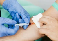 Anemija nustatoma kraujo tyrimais