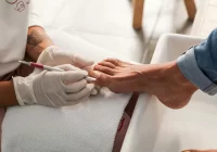 Nagų grybelio gydymas – vietiniai ir geriamieji priešgrybeliniai vaistai bei pažeisti nagai